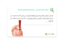 صورة أعراض القدم السكري … ومضاعفاتها وطرق علاجها