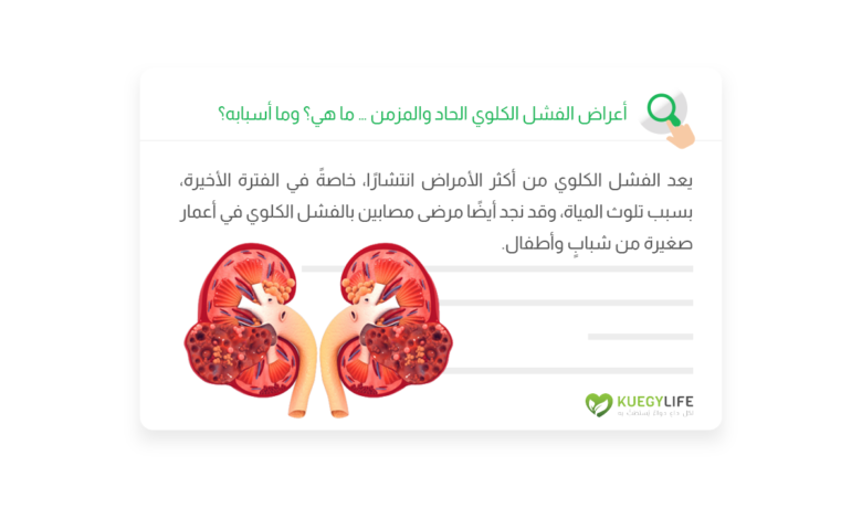 symptoms-of-acut…ic-renal-failure