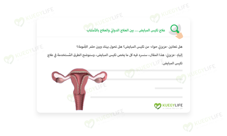 علاج تكيس المبايض